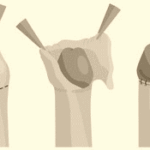 Thumbnail of post image 197